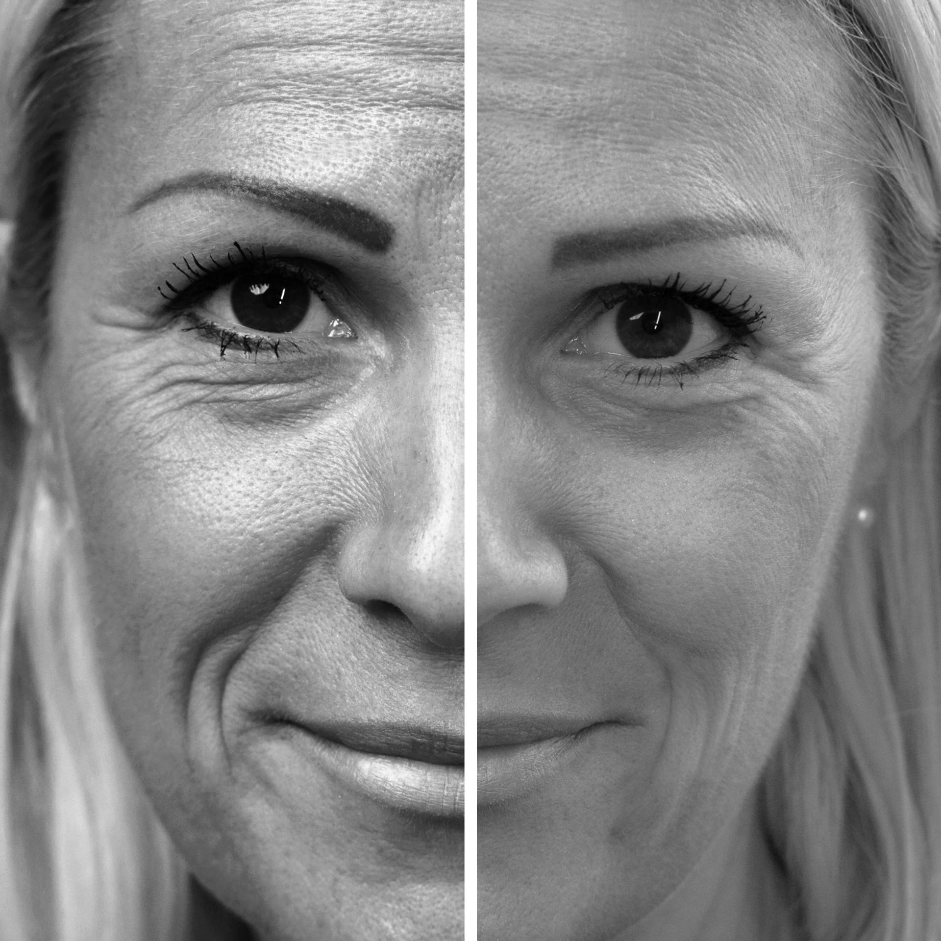 Probaskin_Collagen_Shots_10_Before_After_PDP_Split_Image